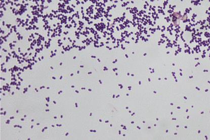 Enterococcus_faecalis