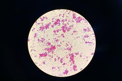 Nontuberculous_Mycobacteria_(NTM)_in_Ziehl-Neelsen_Staining_from_Positive_MGIT_Culture