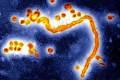 Influenzavirus A, TEM