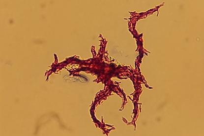 Serpentine_cords_of_red-stained,_acid-fast_structure_in_a_Ziehl-Neelsen_stained_smear_of_Mycobacterium_tuberculosis_complex_(MTBC)_from_liquid_culture