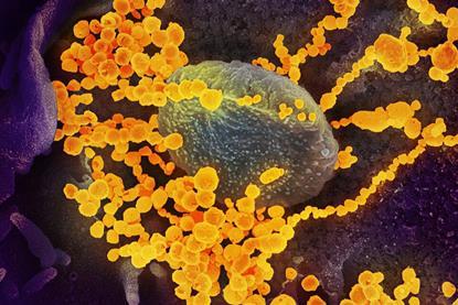 SARS-CoV-2_scanning_electron_microscope_image