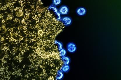 HIV_Virus_Particles_-_53567924670