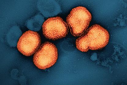 Influenza_A_Virus_(H3N2)_(52747106987)