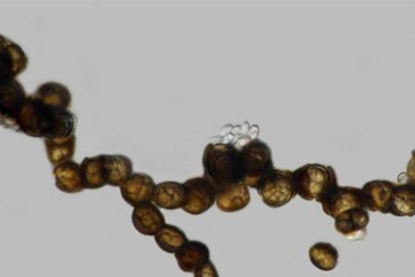 Low-Res_melanized hyphae developing into chlamydospores(1)