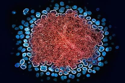 national-institute-of-allergy-and-infectious-diseases-8J7X8DsAIYs-unsplash