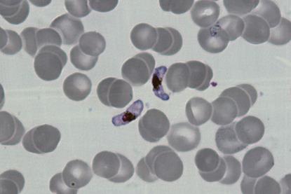P.falciparum-gametocytes