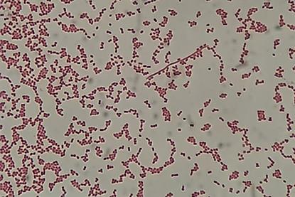 Gram_-negative_cocci_(GNC)_and_Gram_-negative_rod_(GNR)_of_Acinetobactet_baumannii_in_Gram_staining (2)