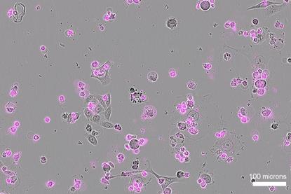 Low-Res_Cas12a2-induced cell death