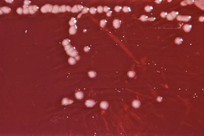 Pseudomonas_aeruginosa_01
