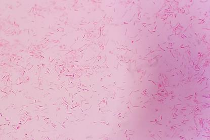 Capnocytophaga_canimorsus_gram_stain