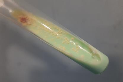 Mycobacterium_tuberculosis_growth_on_L-J_medium (1)