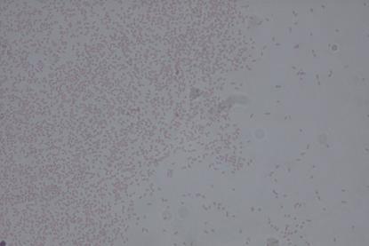 960px-Pantoea_agglomerans