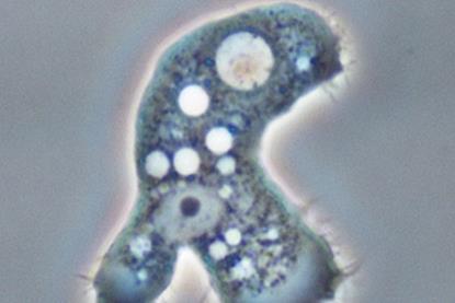 Parasite_Acanthamoeba keratitis