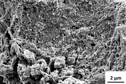 biobatteries
