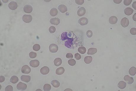 Pseudomonas_aeruginosa_smear_MGG_2010-02-10