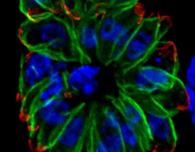 Humans_fibroblasts_infected_with_a_mutant_of_the_intracellular_parasite_Toxoplasma_gondii_-_image.pbio.v10.i12.g001