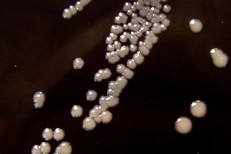 Bordetella_pertussis_on_Charcoal_Agar_supplemented_with_Cephalexin_-_Detail