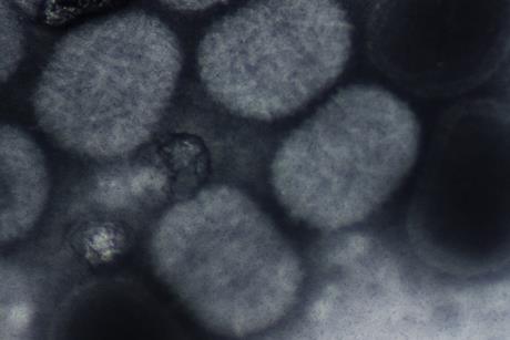 Molluscum_contagiousum_virus_(negative_staining)