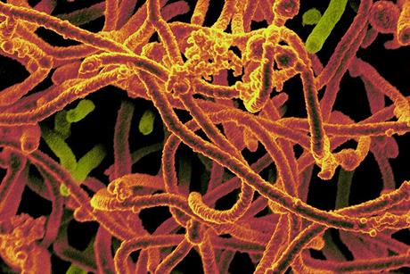 Ebola_Virus_From_Mali_Blood_Sample_(16465524896)