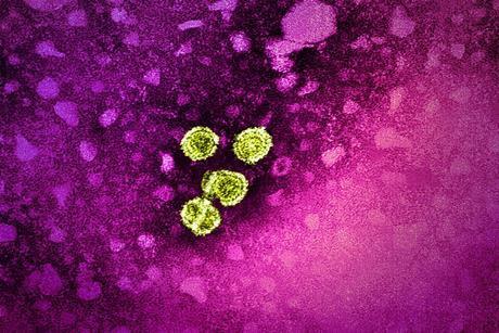 Hepatitis_B_Virus_(52451626575)