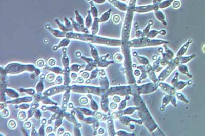 Trichoderma_harzianum