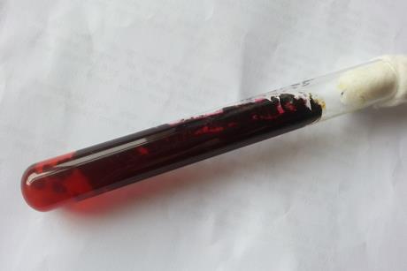 Ochroconis_gallopava_growth_on_SDA_after_4_days_of_incubation_showing_red_to_maroon_pigment_around_the_colony