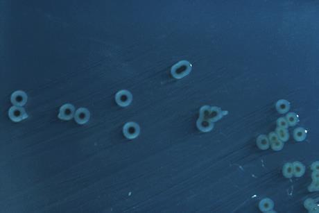 Salmonella_enterica_serovar_typhimurium_01