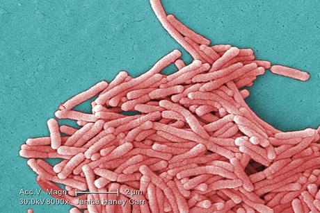 Legionella_pneumophila_(SEM)