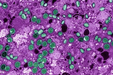 Mpox_Virus_-_53922109282