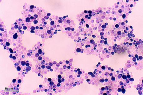 Candida_albicans_(248_35)