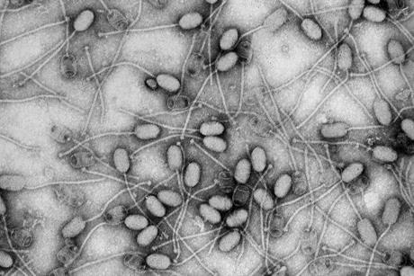 Phage_de_S_aureus_3A