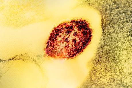Measles_Virus_Particle