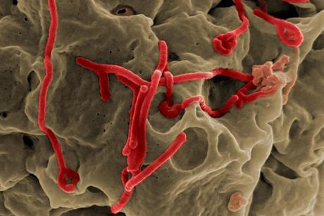 Ebola_Virus_(3)