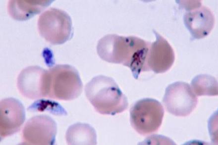Plasmodium