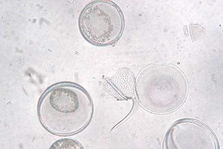 Coscinodiscus_granii