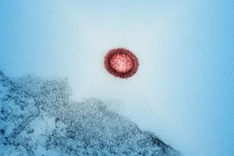 HIV-1_Virus_Particle_-_53587553684