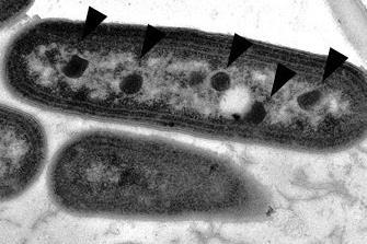 Alpha_and_beta_carboxysomes-B