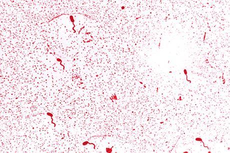 Vibrio_cholerae_01