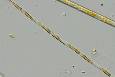 Low-Res_Image_503_Pseudo-nitzschia_CW_PML