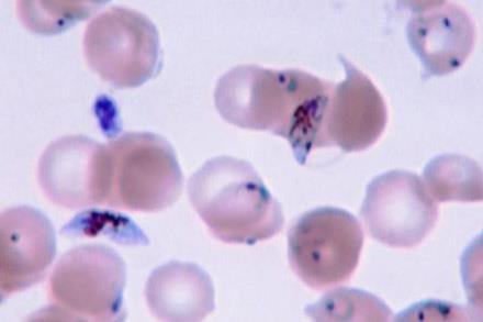 Plasmodium