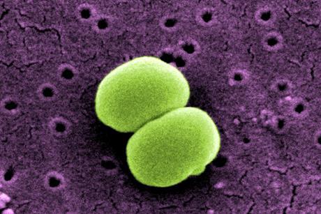 scanning-electron-micrograph-of-two-staphylococcus-epidermidis-bacteria-1536x904