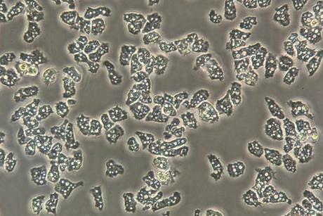 Low-Res_Acanthamoeba