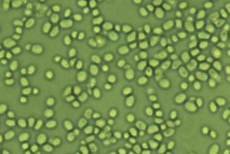 Glabrata (1)