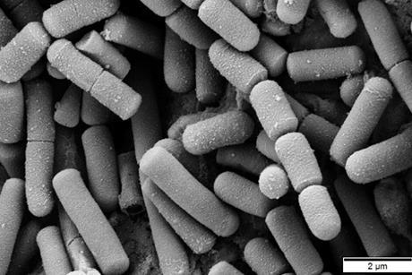 Bacillus_cereus_SEM-cr