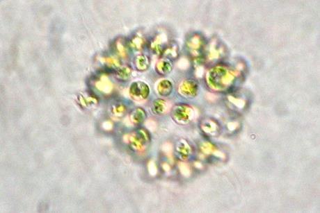 Microcystis_aeruginosa