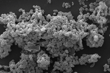 Scanning_electronic_micrograph_of_Akkermansia_muciniphila