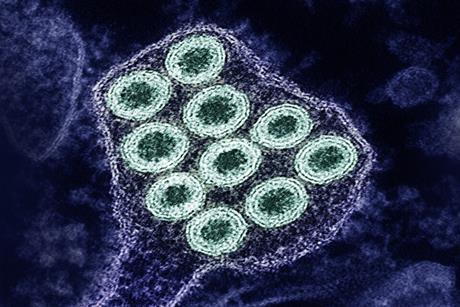 Colorized_transmission_electron_micrograph_of_rabies_virus_particles_(green)_image_captured_at_the_NIAID_Integrated_Research_Facility_in_Fort_Detrick,_Maryland_-_1