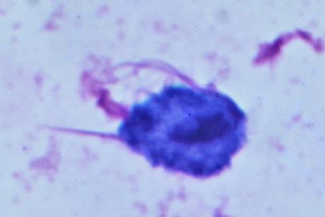 Trichomonas vaginalis_May-Grünwald-Giemsa_staining