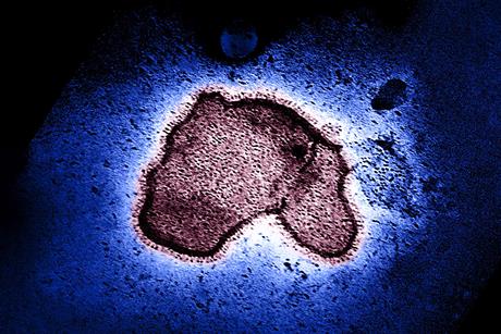 Human_Respiratory_Syncytial_Virus_(RSV)_-_2111