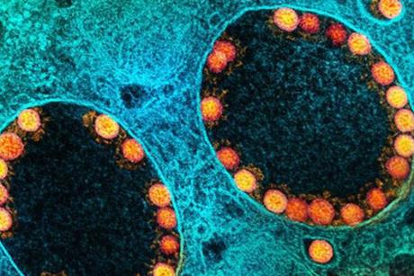 Low-Res_COVID-19 NIAID